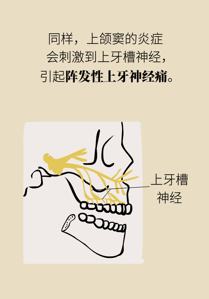 為什么鼻竇發(fā)炎，疼的卻是頭、眼和牙？