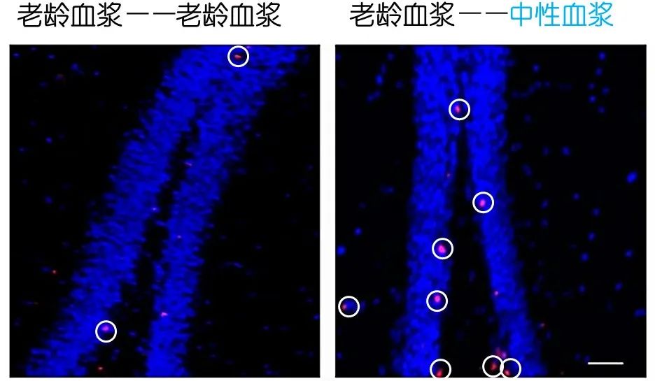 重返年輕不用大換血，只要給血液“兌點(diǎn)水”？