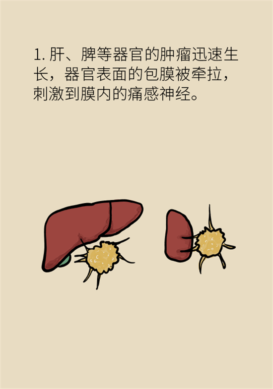 癌癥到底有多痛？需要注意這7個重點問題