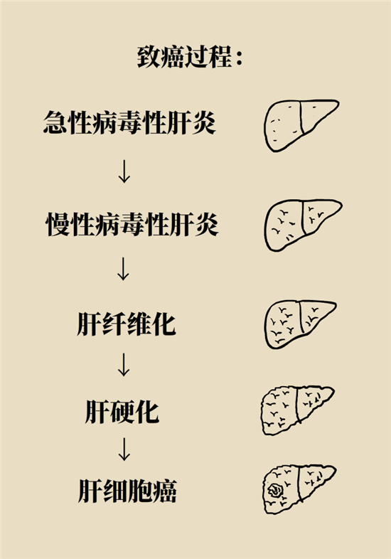 癌癥會(huì)傳染嗎？專(zhuān)家：這些高危因素得注意