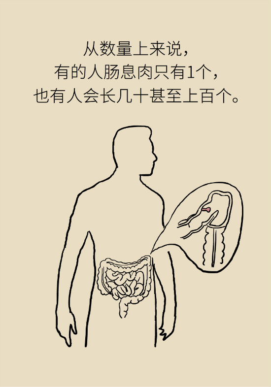 大腸癌科普動漫制作