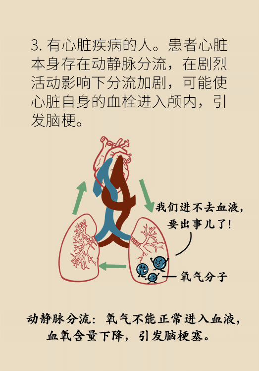 腦梗醫(yī)學(xué)科普動(dòng)漫設(shè)計(jì)