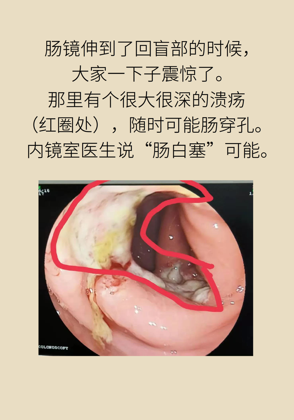 長(zhǎng)白塞病醫(yī)學(xué)知識(shí)科普動(dòng)畫制作