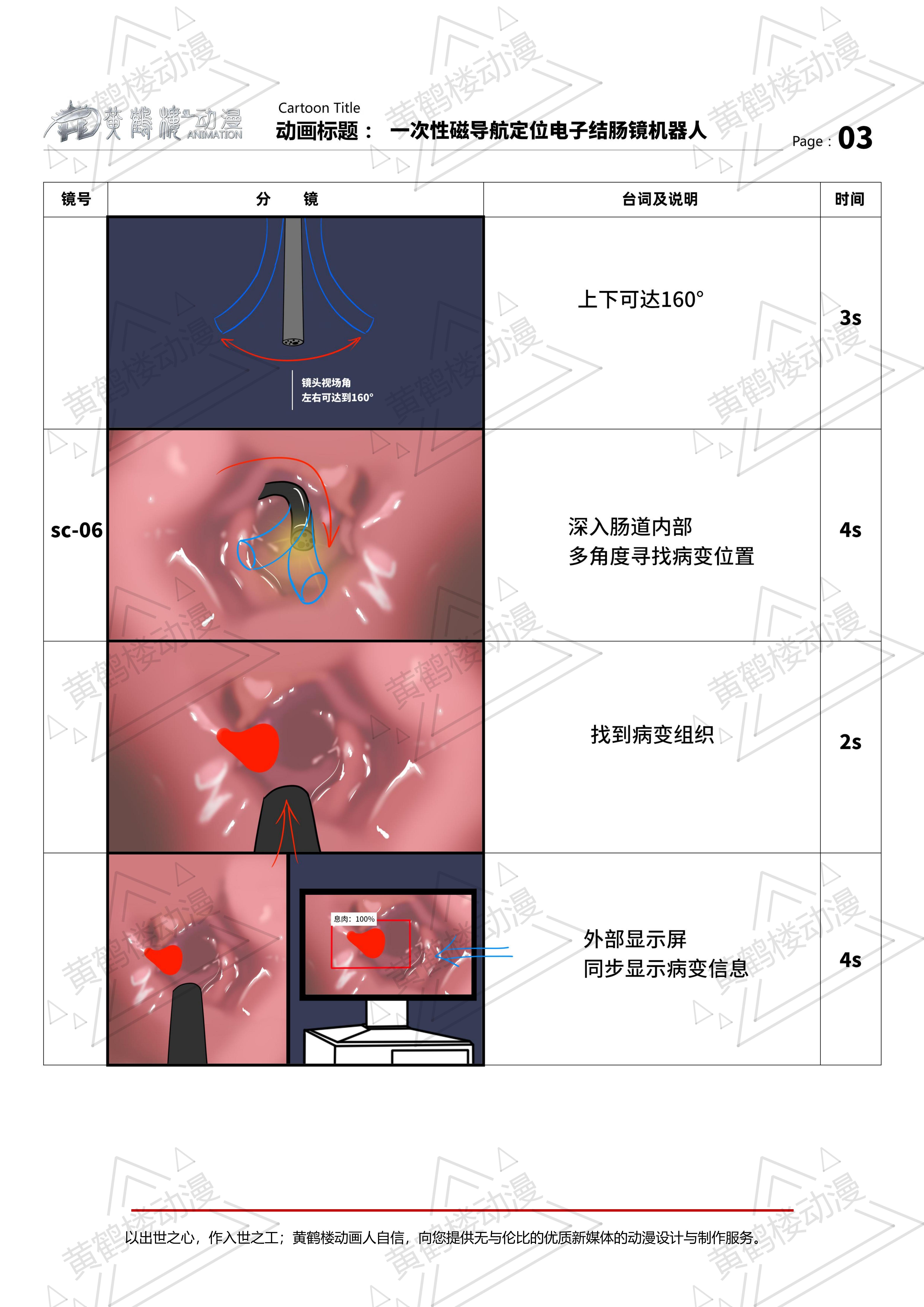 一次性磁導航定位電子結腸鏡機器人三維動畫分鏡210514_02.jpg